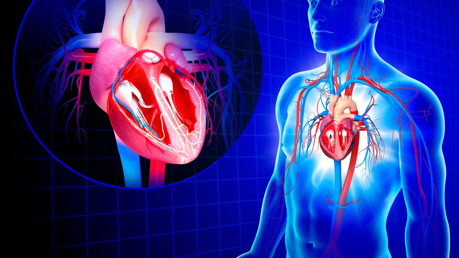 Arteroskleroza e arterieve karotide